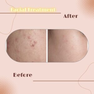 LINE_ALBUM_Review Facial Treatment_230817_1
