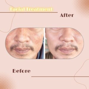 LINE_ALBUM_Review Facial Treatment_230817_10