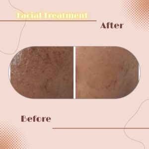 LINE_ALBUM_Review Facial Treatment_230817_2