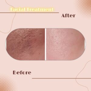 LINE_ALBUM_Review Facial Treatment_230817_3