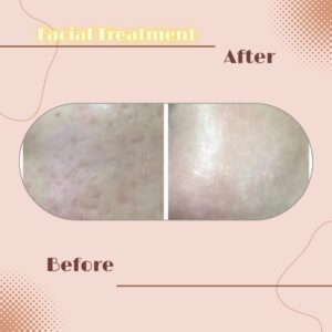 LINE_ALBUM_Review Facial Treatment_230817_4