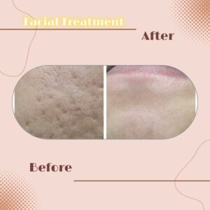 LINE_ALBUM_Review Facial Treatment_230817_5