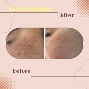 LINE_ALBUM_Review Facial Treatment_230817_6