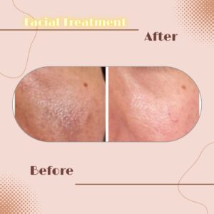 LINE_ALBUM_Review Facial Treatment_230817_9