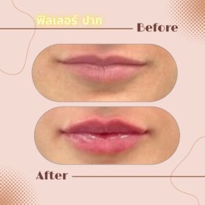 LINE_ALBUM_Review Filler_230817_11