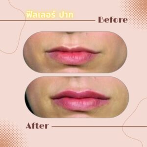 LINE_ALBUM_Review Filler_230817_13