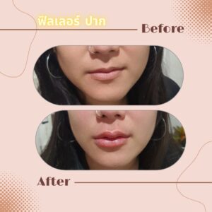 LINE_ALBUM_Review Filler_230817_15