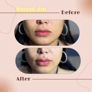 LINE_ALBUM_Review Filler_230817_16