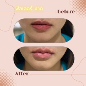 LINE_ALBUM_Review Filler_230817_19