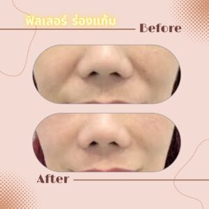 LINE_ALBUM_Review Filler_230817_21
