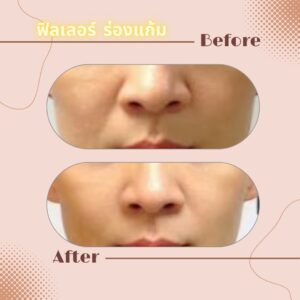 LINE_ALBUM_Review Filler_230817_22