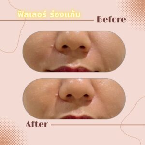 LINE_ALBUM_Review Filler_230817_25
