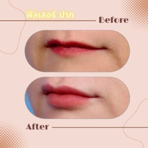 LINE_ALBUM_Review Filler_230817_4