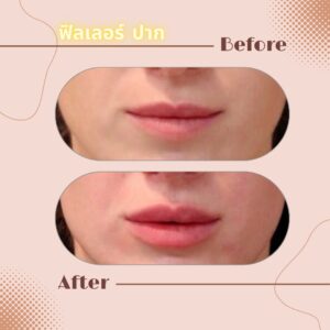 LINE_ALBUM_Review Filler_230817_5