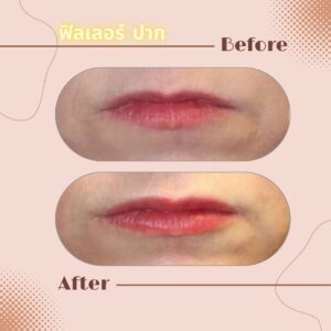LINE_ALBUM_Review Filler_230817_7