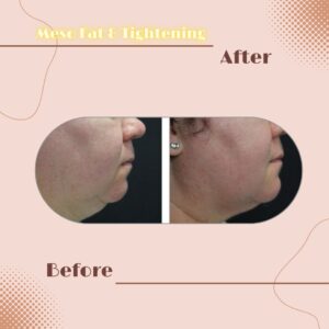 LINE_ALBUM_Review Slim _ Tightening_230817_12