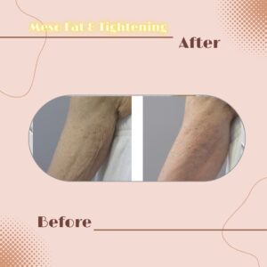 LINE_ALBUM_Review Slim _ Tightening_230817_13