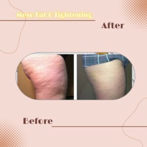 LINE_ALBUM_Review Slim _ Tightening_230817_2