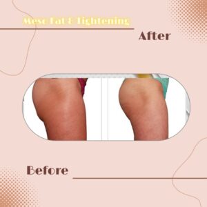 LINE_ALBUM_Review Slim _ Tightening_230817_3