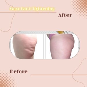 LINE_ALBUM_Review Slim _ Tightening_230817_4