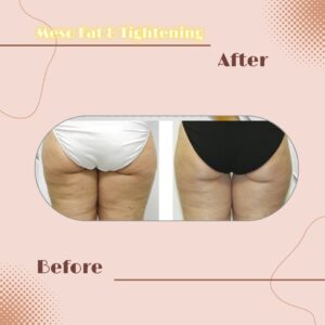 LINE_ALBUM_Review Slim _ Tightening_230817_5