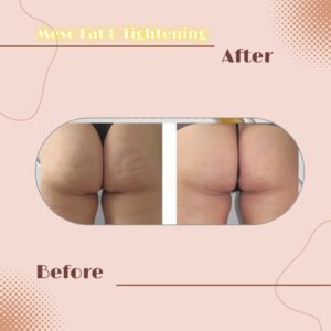 LINE_ALBUM_Review Slim _ Tightening_230817_6