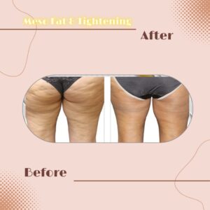 LINE_ALBUM_Review Slim _ Tightening_230817_7