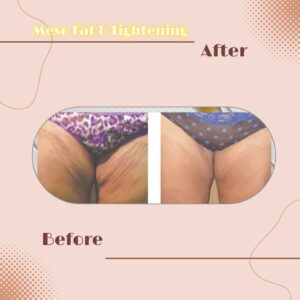 LINE_ALBUM_Review Slim _ Tightening_230817_8