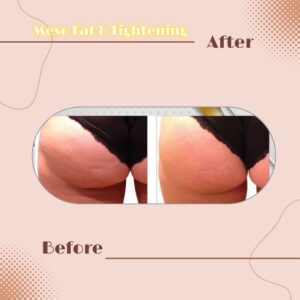 LINE_ALBUM_Review Slim _ Tightening_230817_9