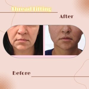 LINE_ALBUM_Review Thread lift_230817_10
