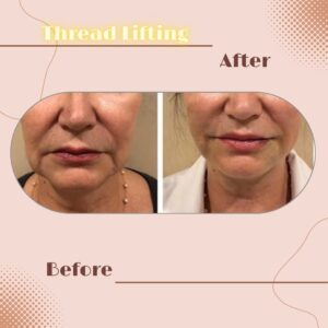 LINE_ALBUM_Review Thread lift_230817_11