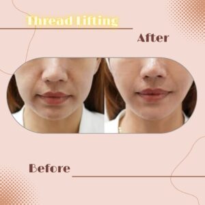 LINE_ALBUM_Review Thread lift_230817_12