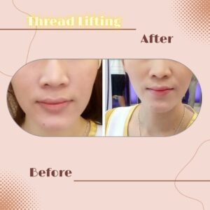 LINE_ALBUM_Review Thread lift_230817_2