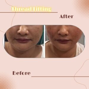 LINE_ALBUM_Review Thread lift_230817_3