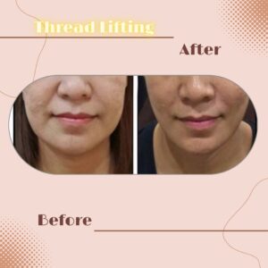 LINE_ALBUM_Review Thread lift_230817_4