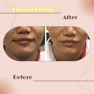 LINE_ALBUM_Review Thread lift_230817_5