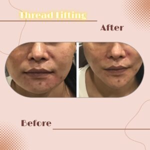 LINE_ALBUM_Review Thread lift_230817_6