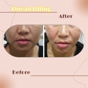 LINE_ALBUM_Review Thread lift_230817_7