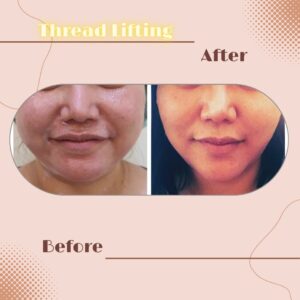 LINE_ALBUM_Review Thread lift_230817_8