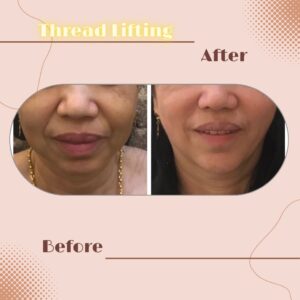 LINE_ALBUM_Review Thread lift_230817_9