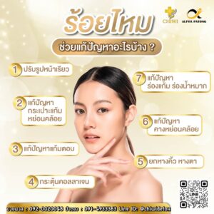 ร้อยไหม: เทรนด์ความงามที่ช่วยยกกระชับและคืนความอ่อนเยาว์