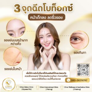 ตำแหน่งฉีดโบท็อกซ์